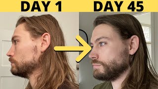 How To Grow MORE Facial Hair WITHOUT MINOXIDIL [upl. by Leahkim923]