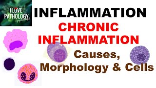 INFLAMMATION 8 CHRONIC INFLAMMATION Causes Morphology amp Cells [upl. by Ronald]