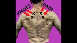 Rhomboid Pain Relief Exercises To Fix Your Upper Back [upl. by Fanny]