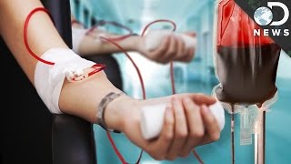 How Do Blood Transfusions Work [upl. by Arst]