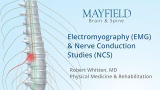 Electromyography EMG amp Nerve conduction studies NCS [upl. by Kcireddor]