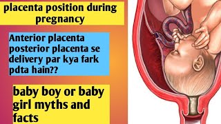 Placenta Previa होने के लक्षण इलाज और Low Lying Placenta से कैसे बचे [upl. by Salvucci]