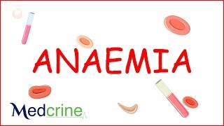 Anemia  causes classification clinical features treatment [upl. by Aenea472]