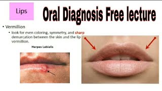 Intraoral Examination Oral Diagnosis [upl. by Earized]