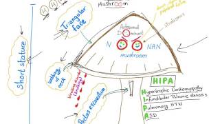 Noonan Syndrome  The Mushroom mnemonic [upl. by Ivz391]