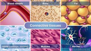 Understanding Soft Tissue Sarcoma [upl. by Anitsud]