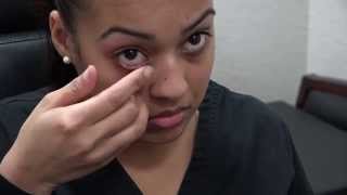 How to Apply Ointment to the Eyes and Eyelids [upl. by Ahsoyem]