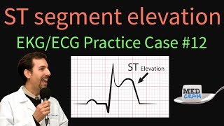 EKG l Interpretation of Sinus Rhythms ECG Overview [upl. by Annecorinne]