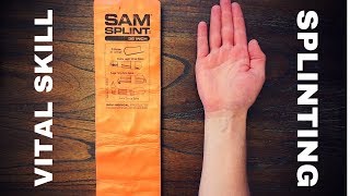 Fundamentals of Splinting [upl. by Conover]