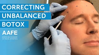 Advanced Botox Injection Techniques for Dentists  Part 3 Masseter Hypertrophy [upl. by Rabelais]