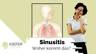 NasennebenhöhlenEntzündung Sinusitis  Krankheitsbild amp Symptome [upl. by Rebecka]