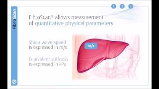 Liver Fibroscan  A smarter alternative to Liver Biopsy l Max Hospital Pitampura [upl. by Ihsorih340]