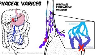 Hypertension artérielle  HTA  Docteur Synapse [upl. by Irabaj233]