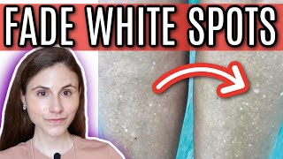 How to FADE WHITE SPOTS from SUN DAMAGE  Dr Dray [upl. by Welcome119]