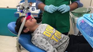 Laughing gas and dental treatments how enjoyable it is for children [upl. by Muhcon892]