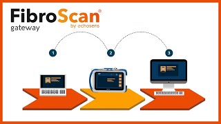 Doctors Fibroscan a noninvasive liver test [upl. by Gallard385]