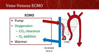 Thinking Simple  ECMO [upl. by Bennet625]