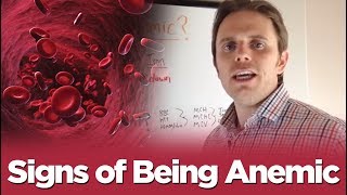 Anemia Symptoms And Treatments  Signs of Being Anemic [upl. by Gage396]