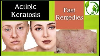 Actinic keratosis Causes and Natural Treatments [upl. by Loren]