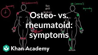 Osteoarthritis vs rheumatoid arthritis symptoms  NCLEXRN  Khan Academy [upl. by Delanty]