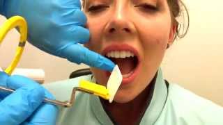 How to Take Periapical Radiographs [upl. by Gunter982]