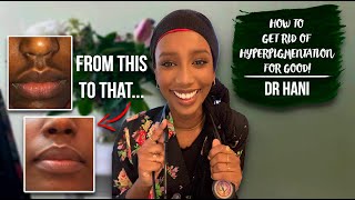 How To Get Rid Of Hyperpigmentation  Dr Hani [upl. by Agatha477]