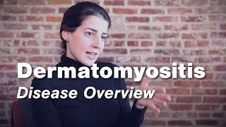 Dermatomyositis  Disease Overview  Johns Hopkins [upl. by Costanza278]