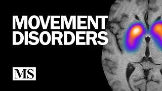 Movement Disorders [upl. by Valley]