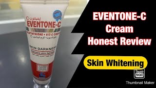 EventoneC Cream 9 Months Honest ReviewSkin Whitening Cream [upl. by Ellahcim508]