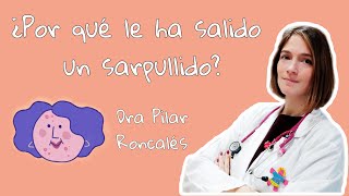 Exantemas o sarpullidos ¿por qué se producen ¿cómo distinguirlos ¿qué debemos hacer [upl. by Nilesoj]