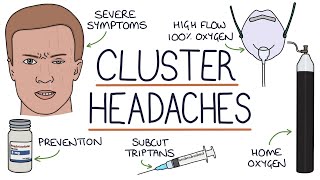 Cluster Headaches [upl. by Llerej751]