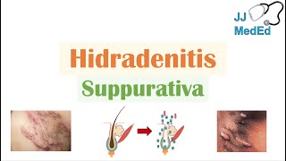 Hidradenitis Suppurativa HS  Pathophysiology Triggers Signs amp Symptoms Diagnosis Treatment [upl. by Wolpert]