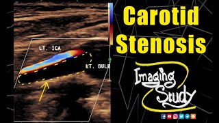 Carotid Artery palpation and auscultation short [upl. by Elizabeth]