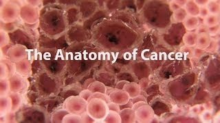 What Is Cancer What Causes Cancer amp How Is It Treated [upl. by Nosreip801]