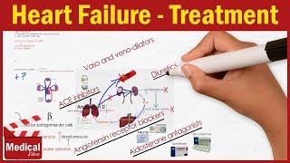 Pharmacology CVS 11 Heart Failure Treatment Part 1 ACE inhibitors  Beta blockers  Diuretics [upl. by Wadesworth328]