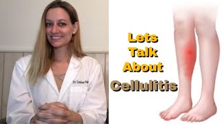 CELLULITIS Everything You Need To Know Symptoms Cause Risk Factors Treatment Prevention [upl. by Macdonell494]