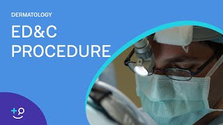 EDampC Procedure Overview Dermatology [upl. by Nahgrom357]