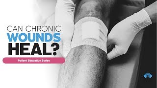 Can Chronic Wounds Heal  Patient Education Series [upl. by Nuahsyar613]