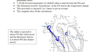 Thermodilution CO [upl. by Cosetta]