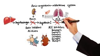 What is Hypertension [upl. by Maryann119]