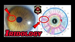 The Only Way To Change Your Eye Color Permanently How To Take An Iridology Picture Of Your Eye [upl. by Galitea]