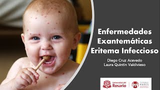 Enfermedades Exantemáticas Eritema infeccioso [upl. by Carline]