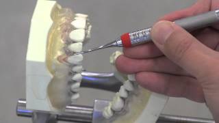 Extraoral Fulcrum scaling Maxillary Anterior Teeth [upl. by Eggleston]