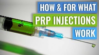 How do PRP injections work [upl. by Eseerahs]