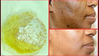 NATURAL EXFOLIATING FACIAL SCRUB FOR CLEARING BLACKHEADS DARK SPOTS DULL DRY SKIN GET CLEAR SKIN [upl. by Bettye]