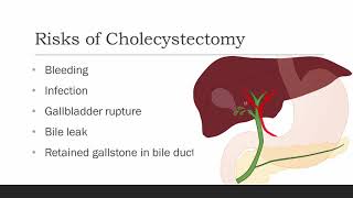 CHOLECYSTITIS Causes Signs and Symptoms Diagnosis and Treatment [upl. by Auhsej428]