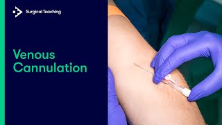 Cannulation How to gain IV access [upl. by Engracia]