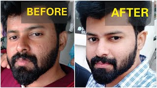 Get brighter skin Naturally in 2 Weeks  No side effects  Tamil  shadhikazeez [upl. by Fleta]