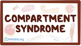 Parkinsons disease  an Osmosis Preview [upl. by Kiel]