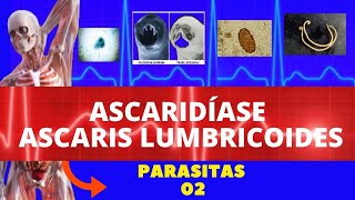 ASCARIDÍASE  ASCARIS LUMBRICOIDES LOMBRIGA  PARASITOLOGIA  INFECTOLOGIA [upl. by Pearman]